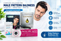 Male Pattern Baldness Kit , ZX Hair , Derma roller, HF Kit, Minoxidil And Finasteride Solution