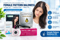 Female Pattern Baldness Kit , HF KIT, PLAIN MINOXIDIL, DERMA ROLLER, XB HAIR